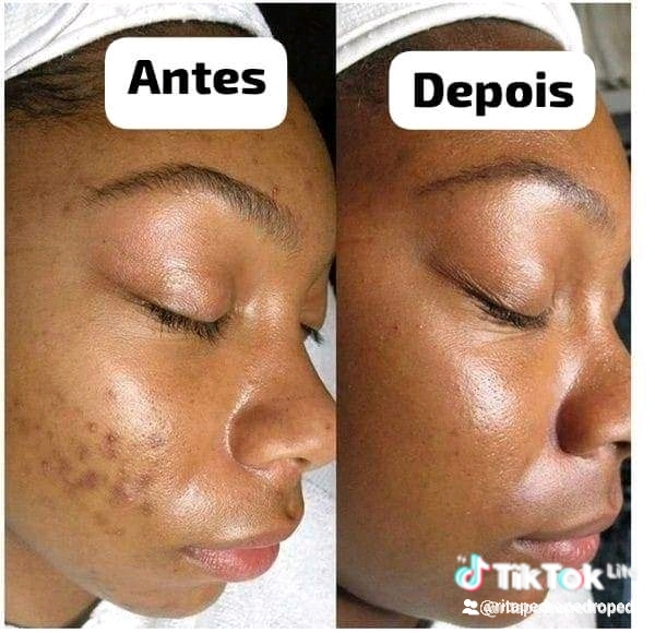 Produtos da la roche de origem francesa 