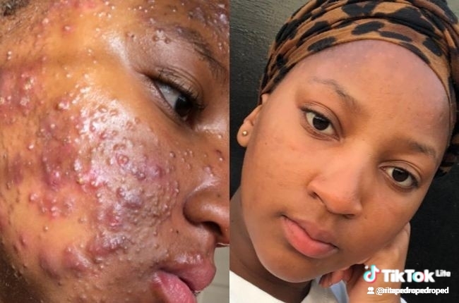 Produtos da la roche de origem francesa  - Imagem 2