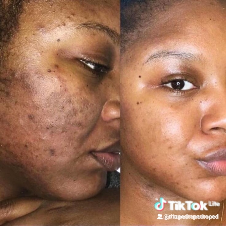 Produtos da la roche de origem francesa  - Imagem 3