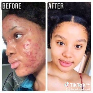 Produtos da la roche de origem francesa  - Imagem 4