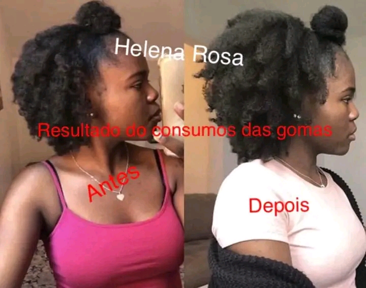 Gomas para crescimento de cabelo unhas e pele