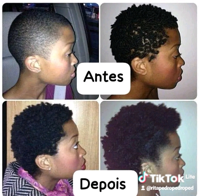 Gomas para crescimento de cabelo unhas e pele - Imagem 3